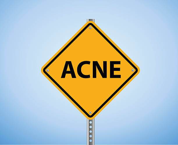 ACNE and How Aromatherapy Can Help