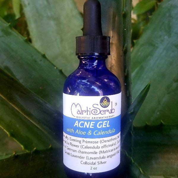 Aromatherapy acne gel bottle with aloe, evening primrose, and calendula on a green leaf background.
